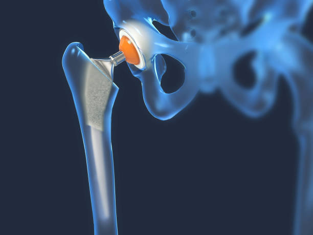 Medical Titanium