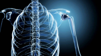 //ikrorwxhpqpqlj5m.ldycdn.com/cloud/lobppkqpplnsrjlljqmkmkjjp/medical-titanium.jpg