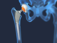 //ikrorwxhpqpqlj5m.ldycdn.com/cloud/prBppKqplnSRqlojorqijm/Medical-Titanium.jpg